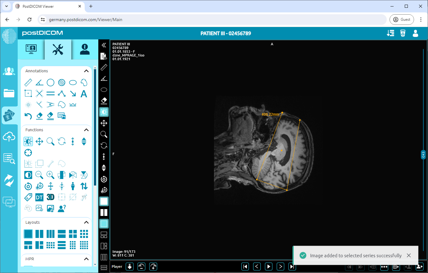 Huidige afbeelding toevoegen als nieuwe serie