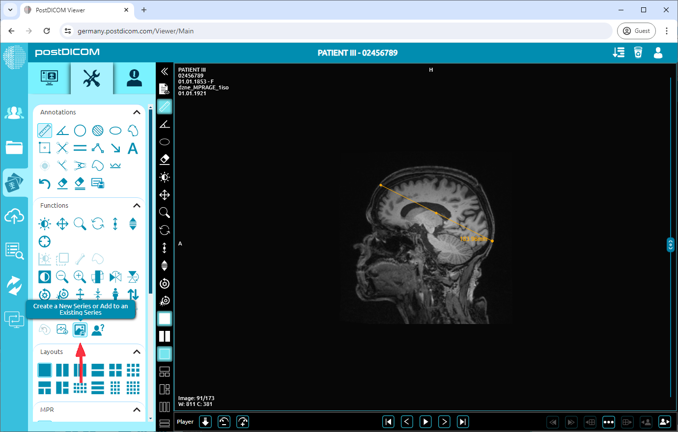 Huidige afbeelding toevoegen als nieuwe serie