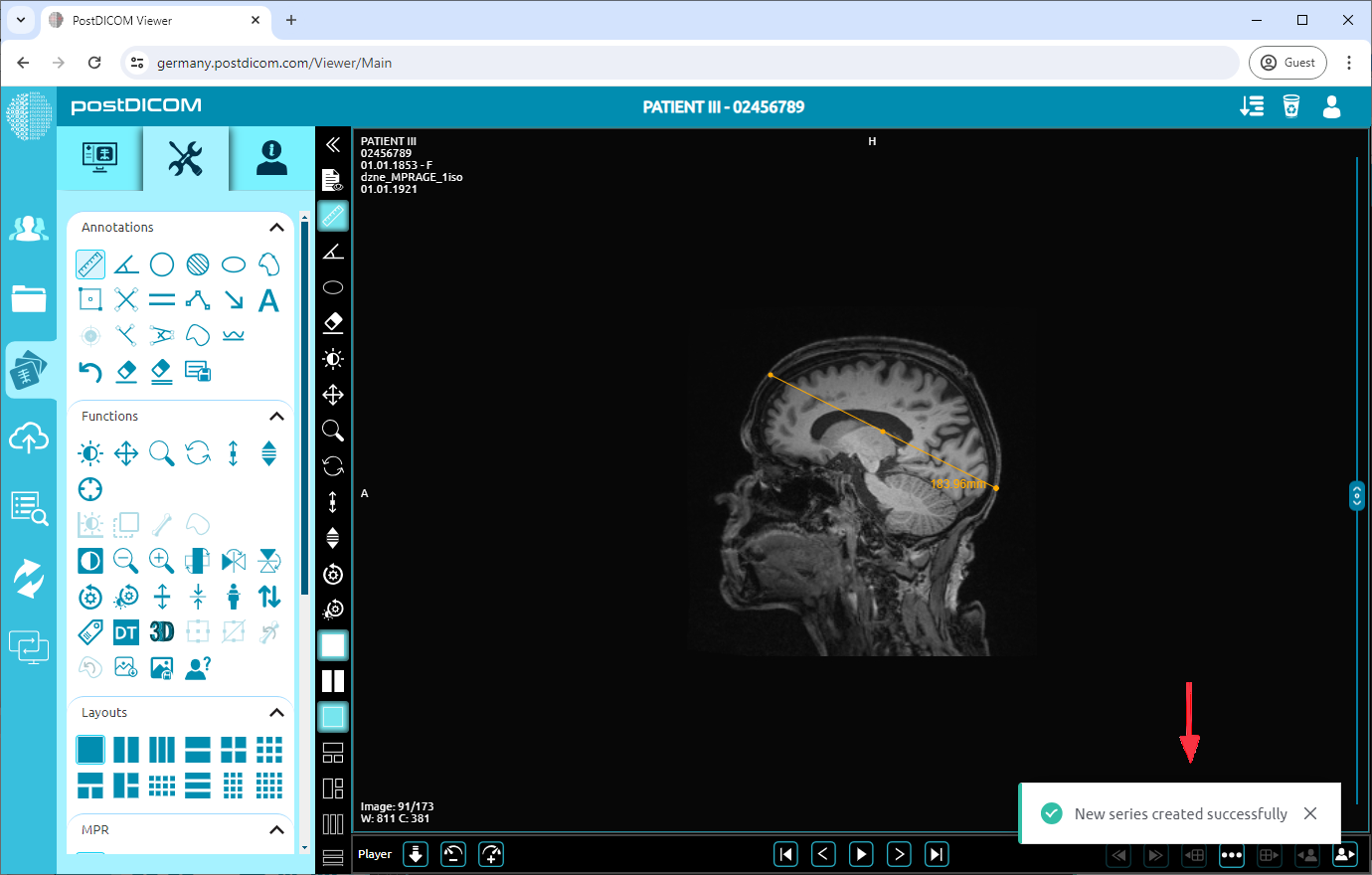 Huidige afbeelding toevoegen als nieuwe serie