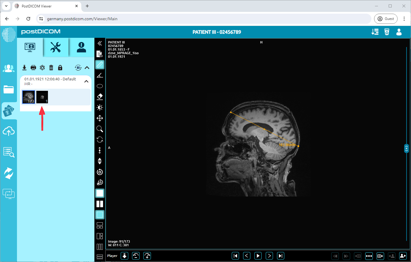 Huidige afbeelding toevoegen als nieuwe serie
