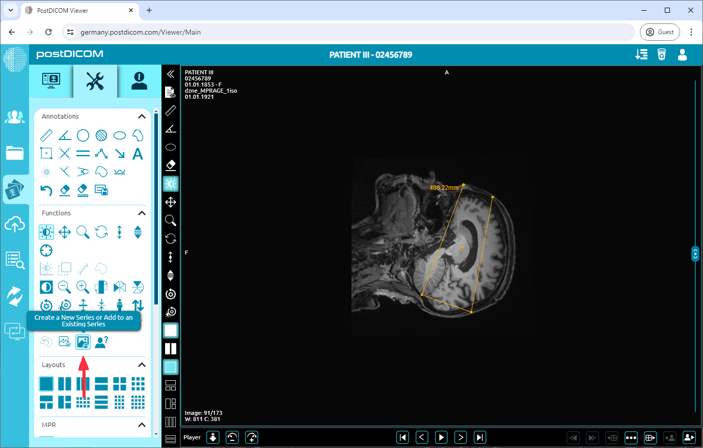 Huidige afbeelding toevoegen als nieuwe serie