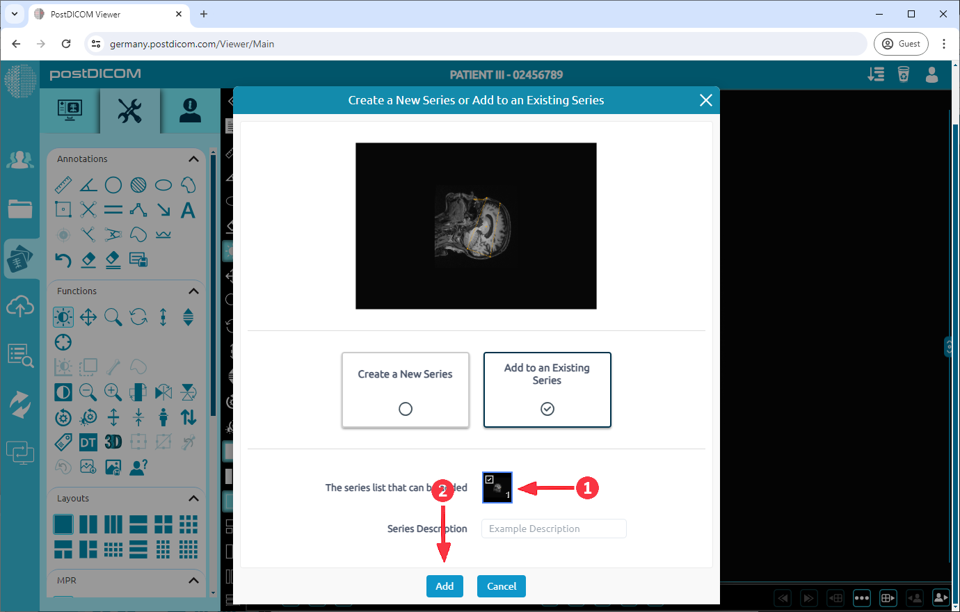 Huidige afbeelding toevoegen als nieuwe serie