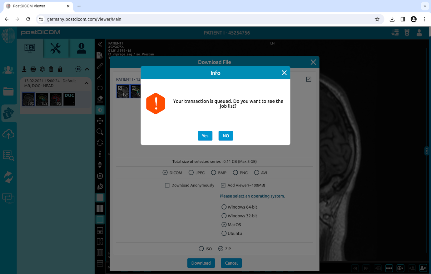 Gebruik van CD Viewer voor MacOS Monterey