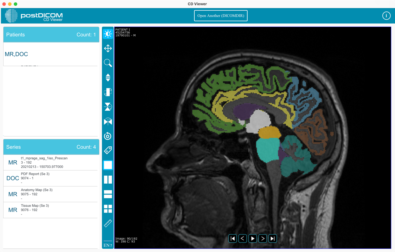 Gebruik CD Viewer voor MacOS Sonoma