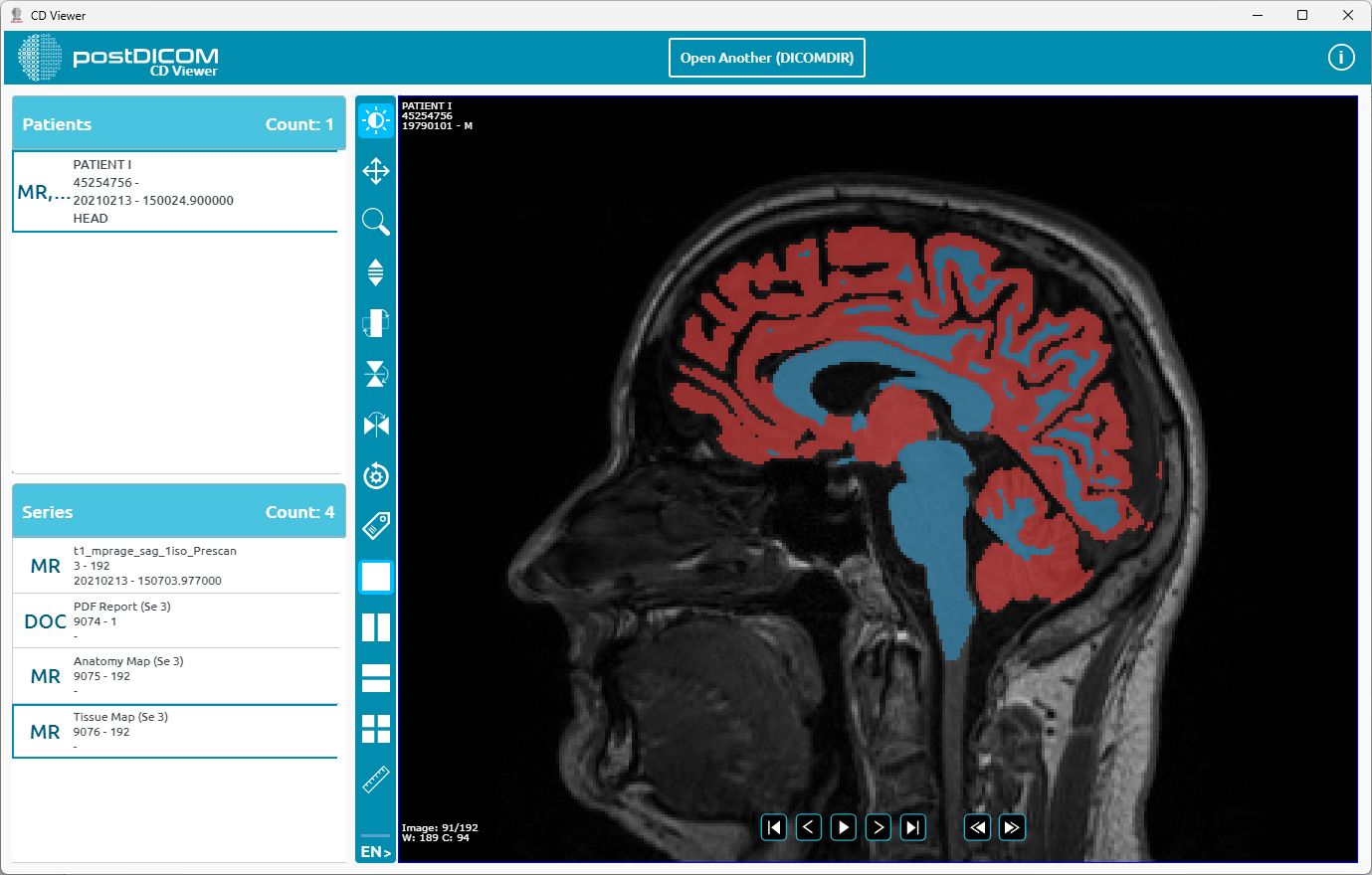Gebruik van CD Viewer voor Windows