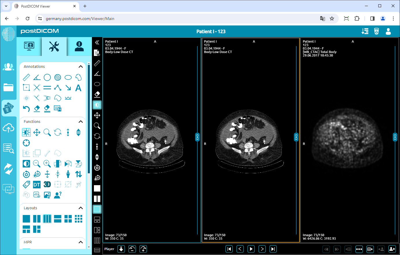 Indeling van het beeldvenster wijzigen