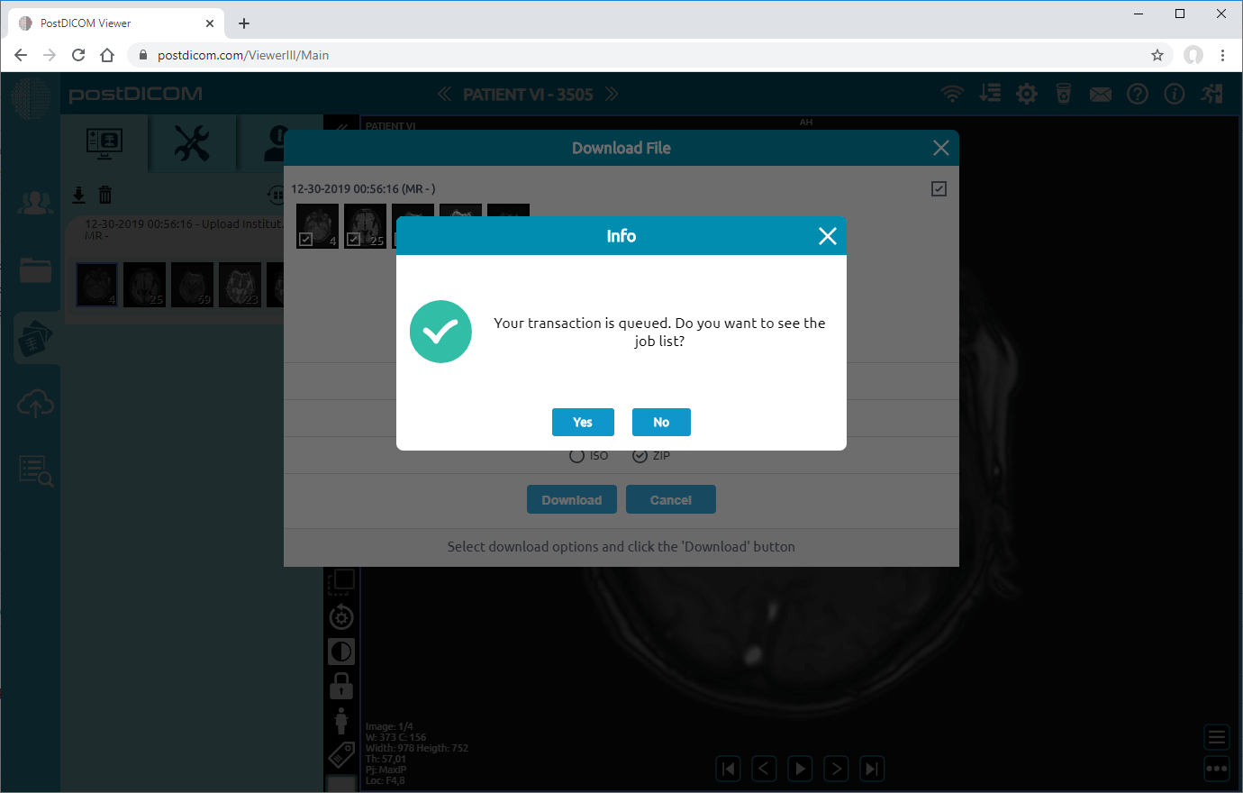 patiëntbeelden downloaden naar schijf