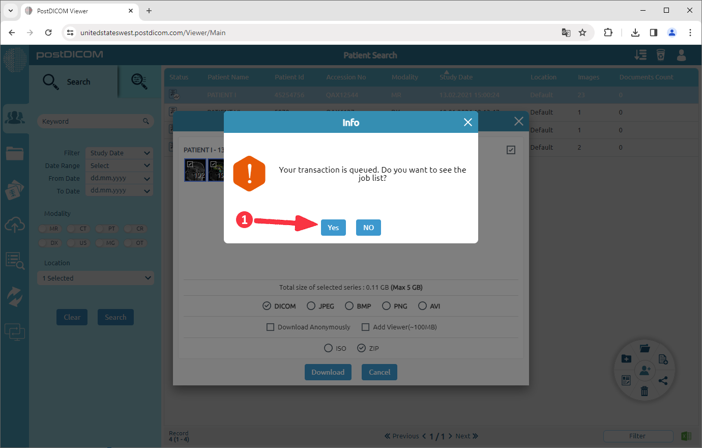 Patiëntafbeeldingen downloaden naar schijf