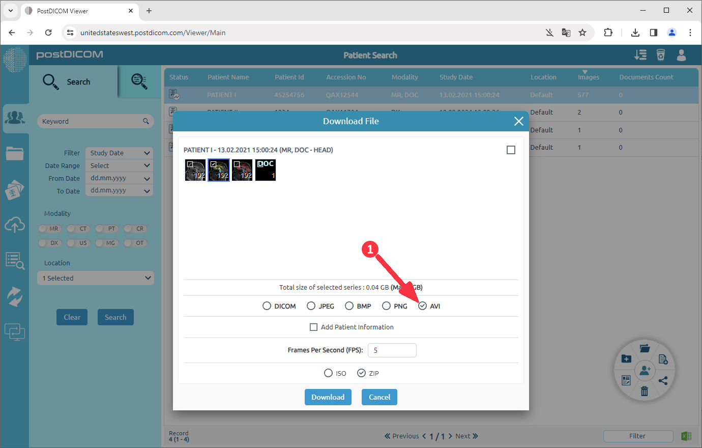 Hoe DICOM-beelden naar AVI te converteren