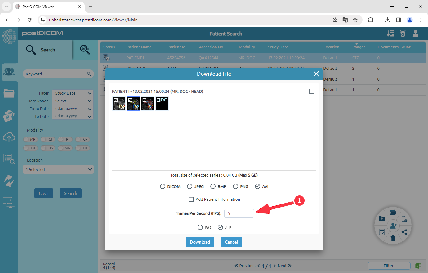 Hoe DICOM-beelden naar AVI te converteren