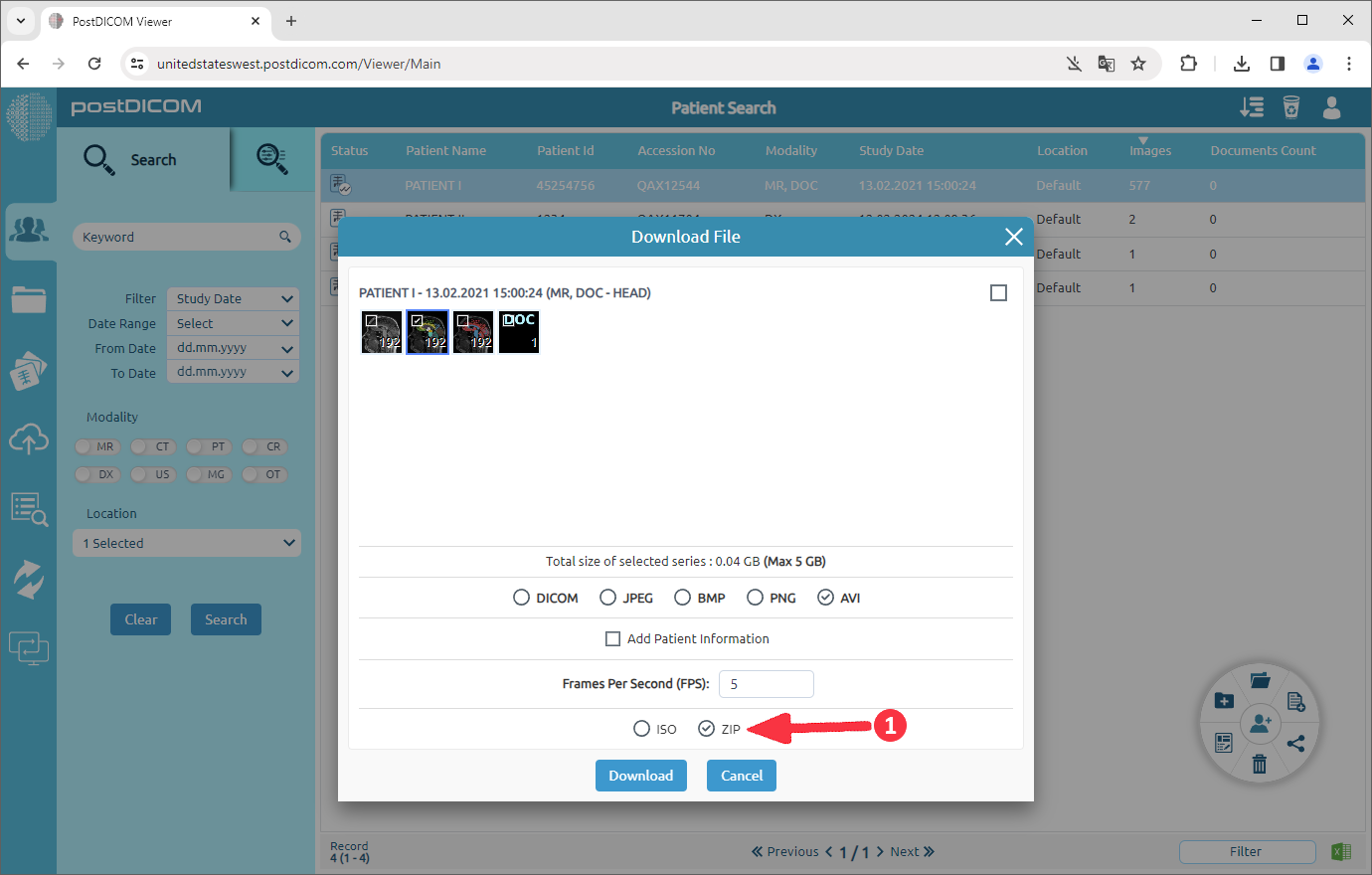 Hoe DICOM-beelden naar AVI te converteren