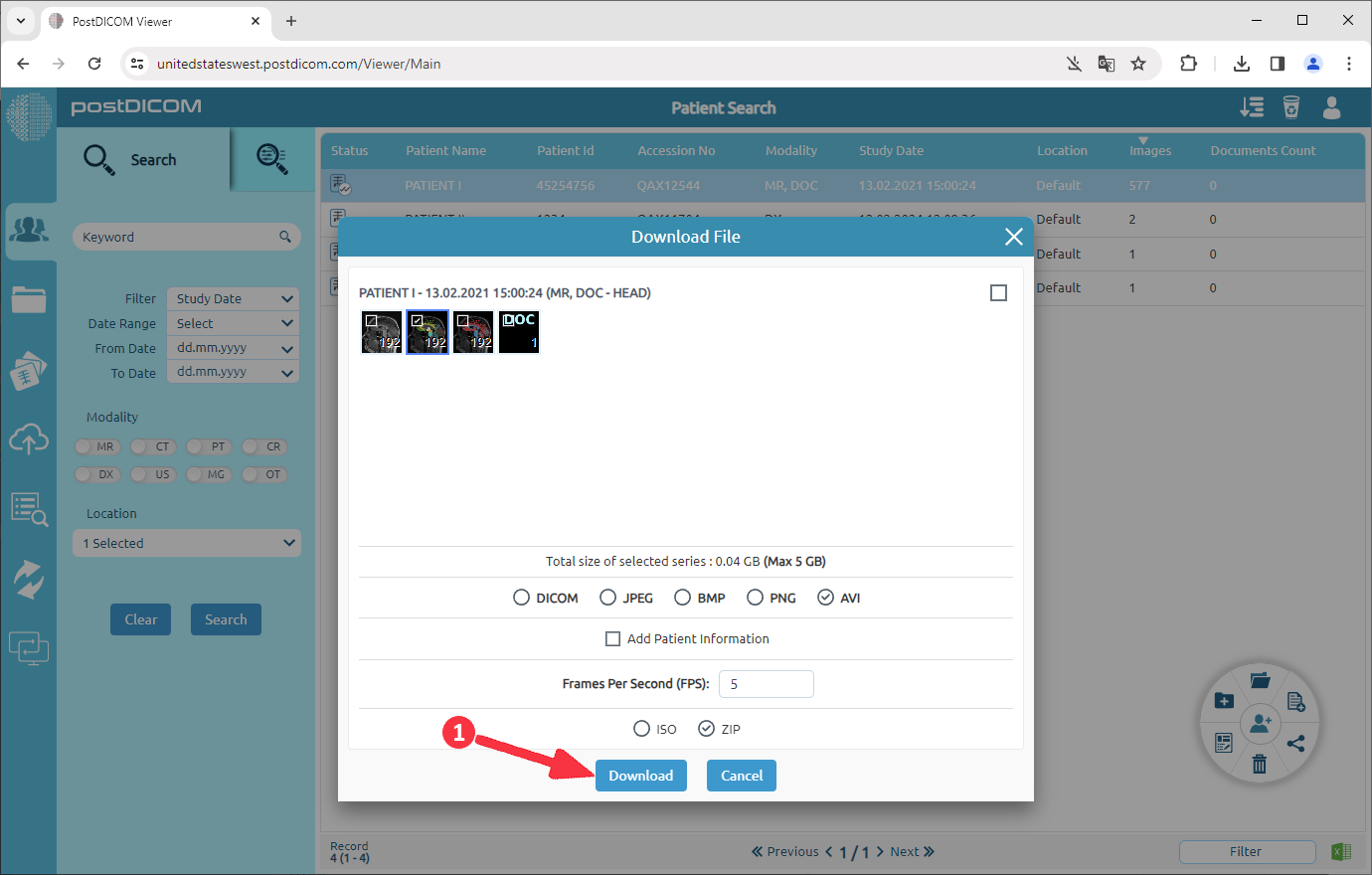 Hoe DICOM-beelden naar AVI te converteren