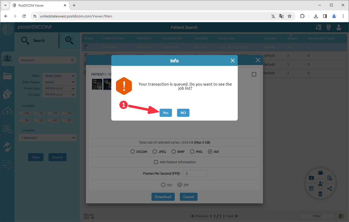 Hoe DICOM-beelden naar AVI te converteren
