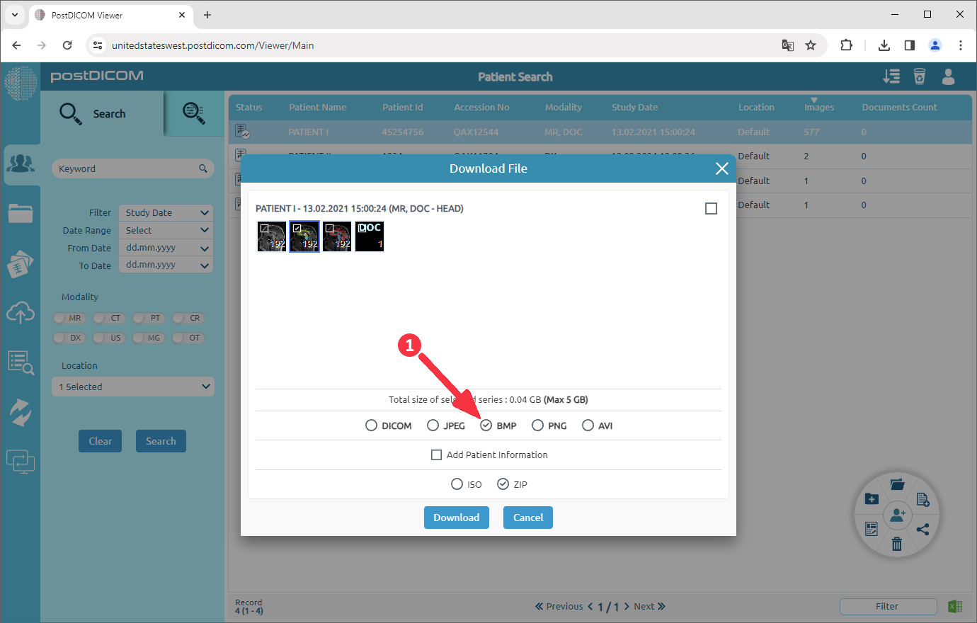 Hoe DICOM-afbeeldingen naar BMP te converteren