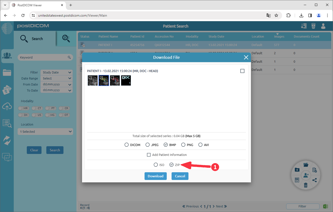 Hoe DICOM-afbeeldingen naar BMP te converteren