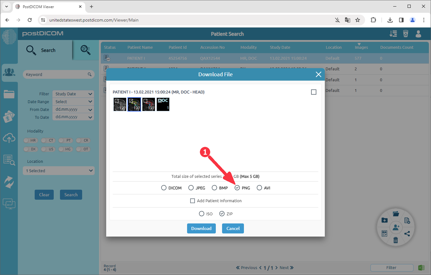Hoe DICOM-beelden converteren naar PNG