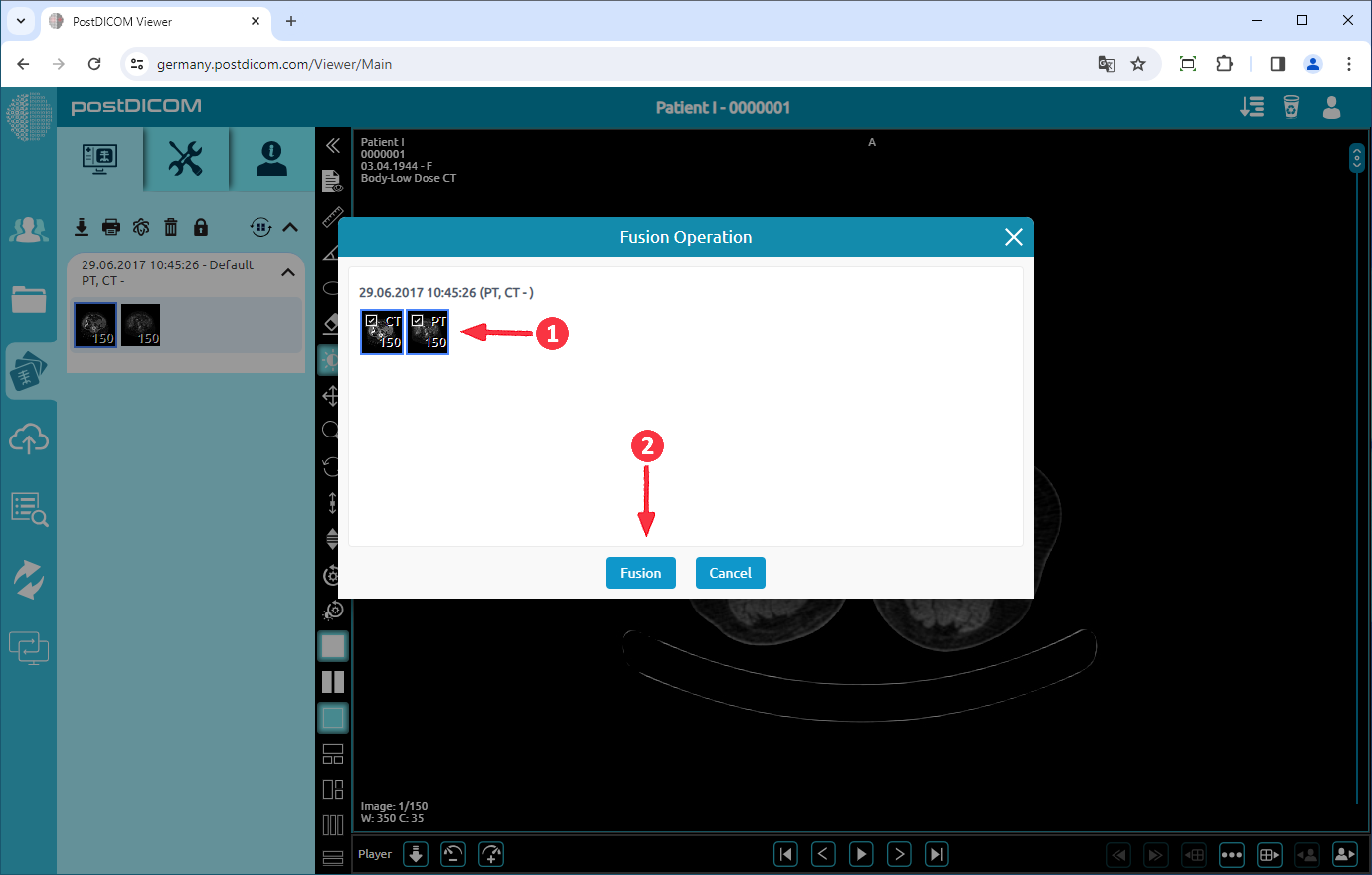 PET/CT, PET/MR-fusie
