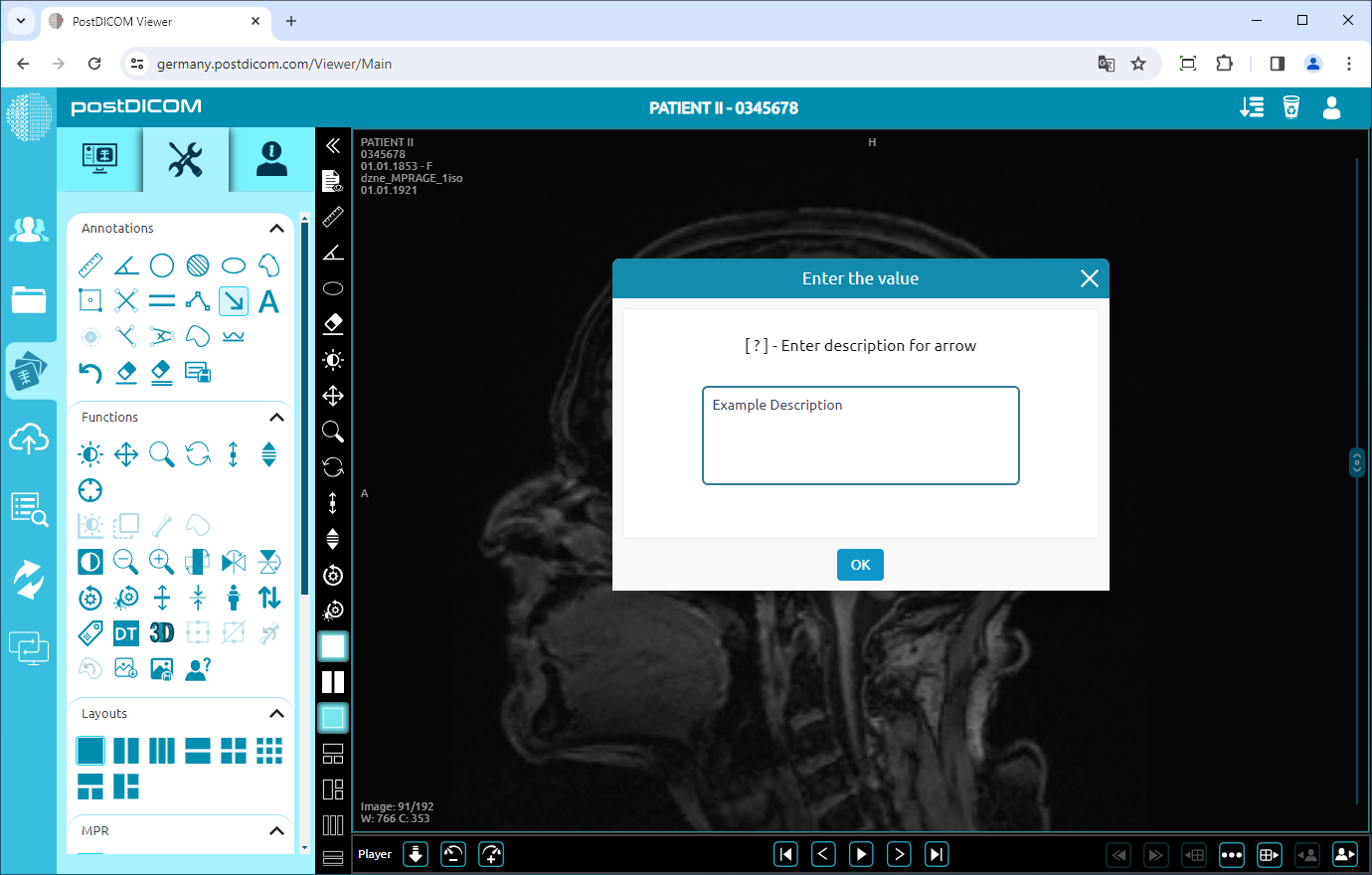 De pijltool gebruiken
