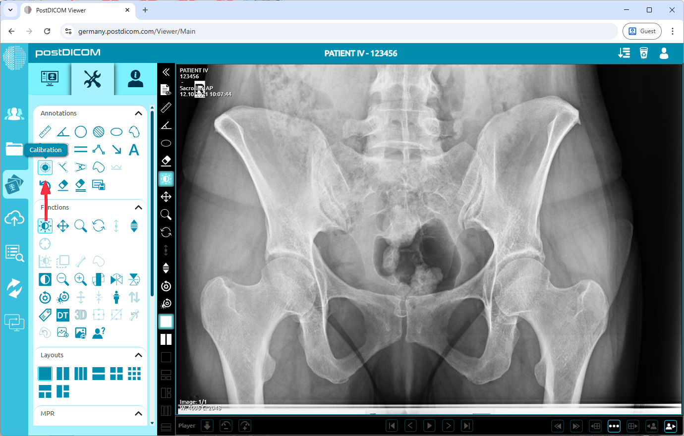 Het kalibratiehulpmiddel gebruiken
