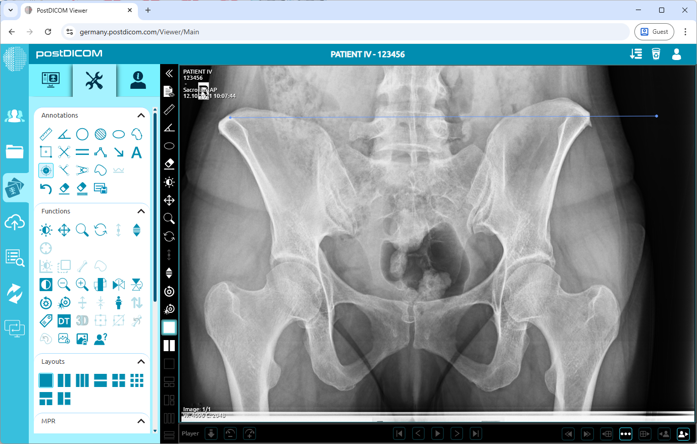 Het kalibratiehulpmiddel gebruiken