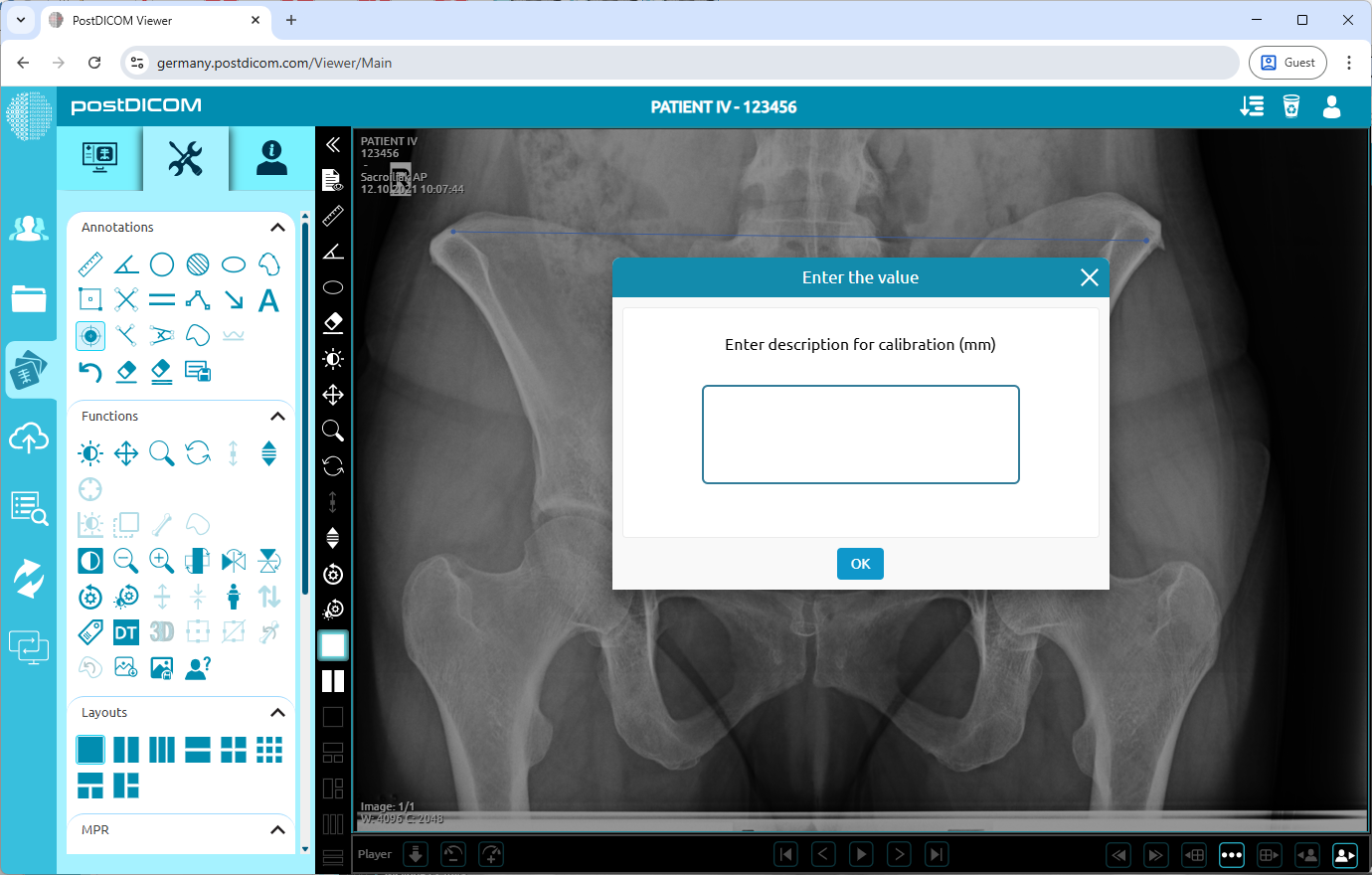Het kalibratiehulpmiddel gebruiken