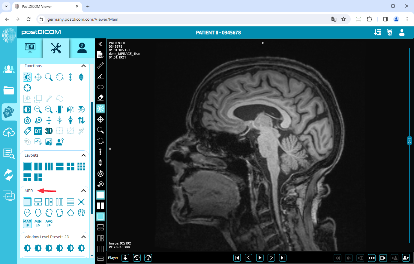 MPR-functies gebruiken