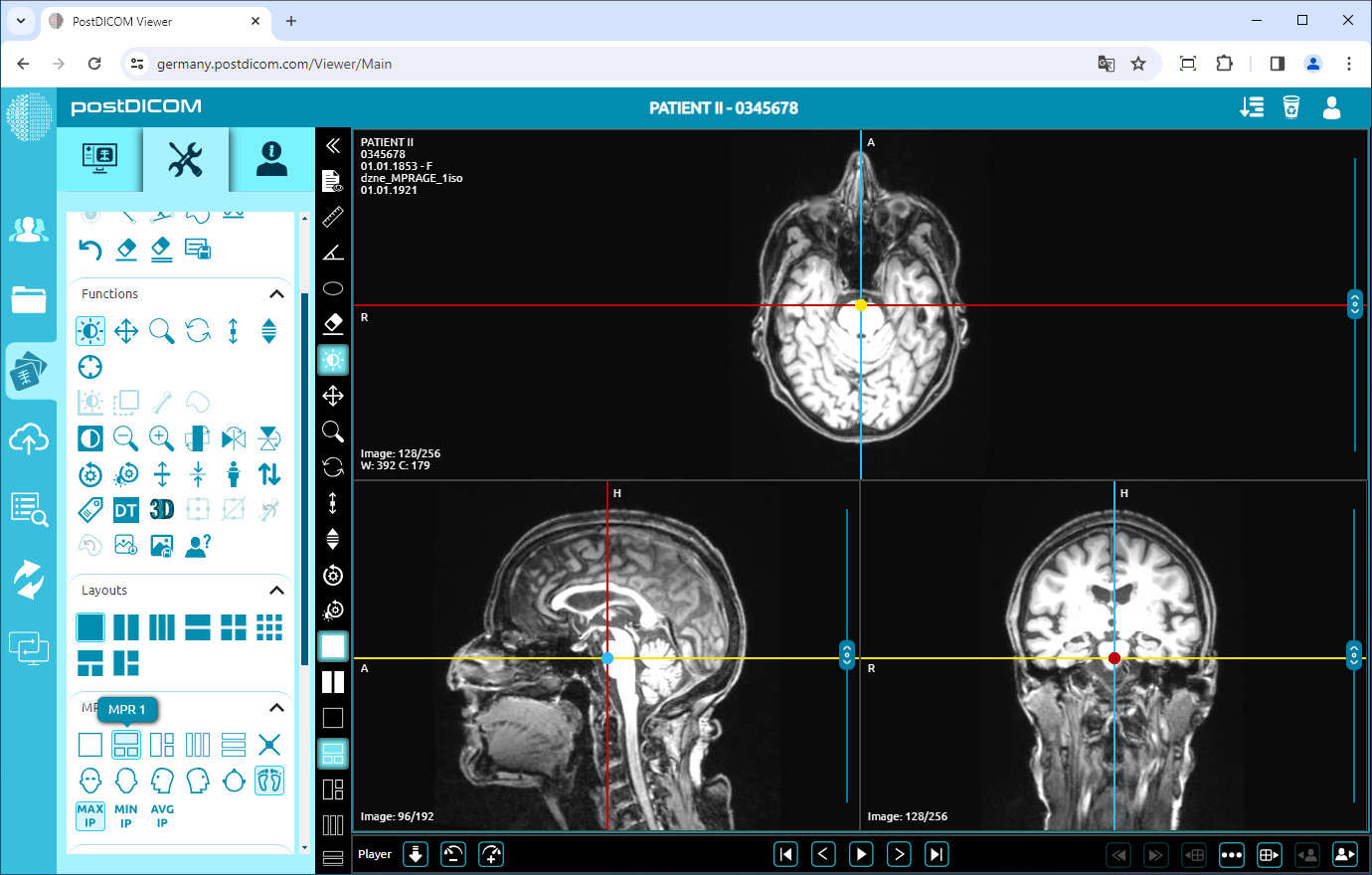 MPR-functies gebruiken