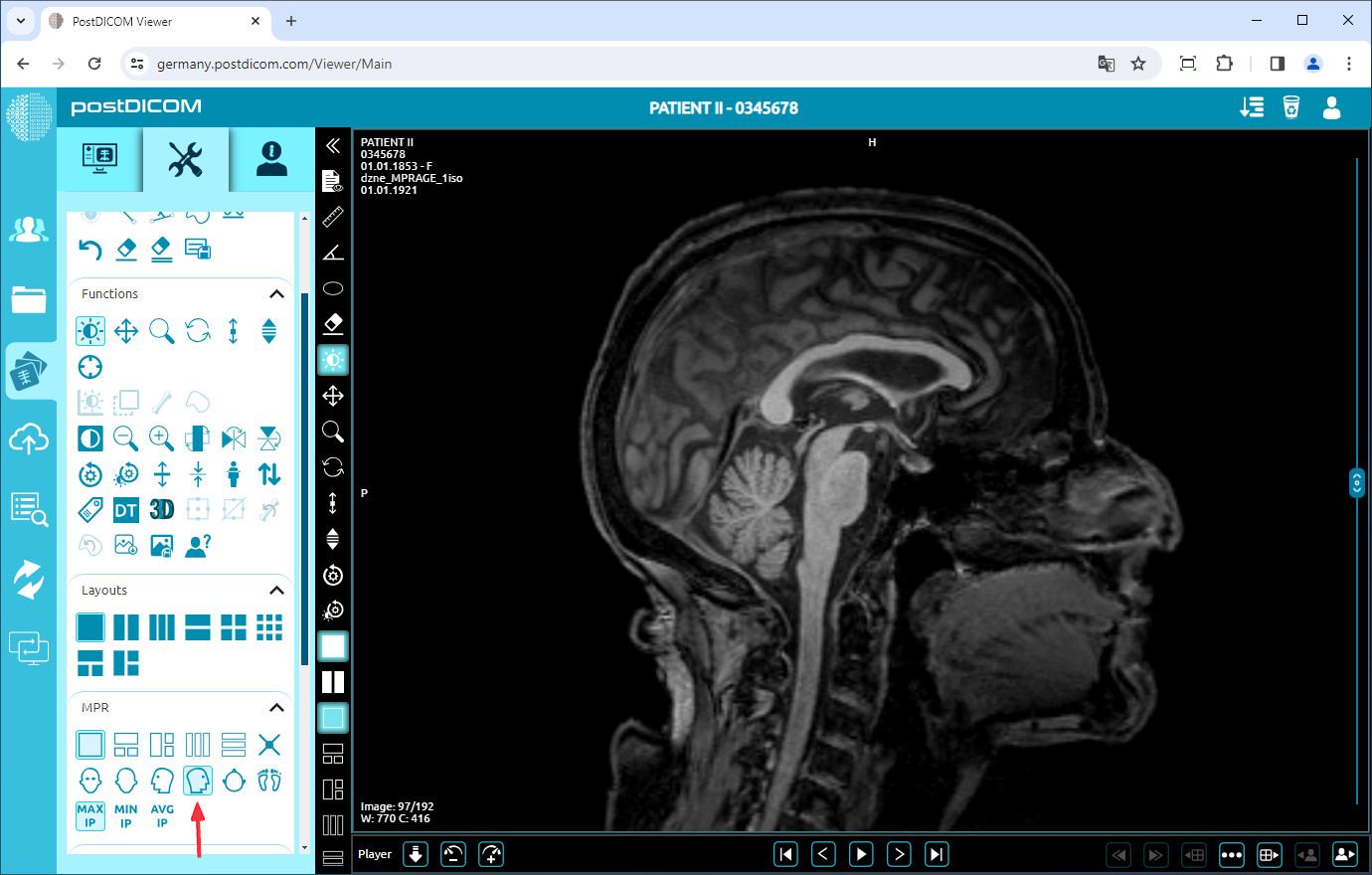 MPR-functies gebruiken