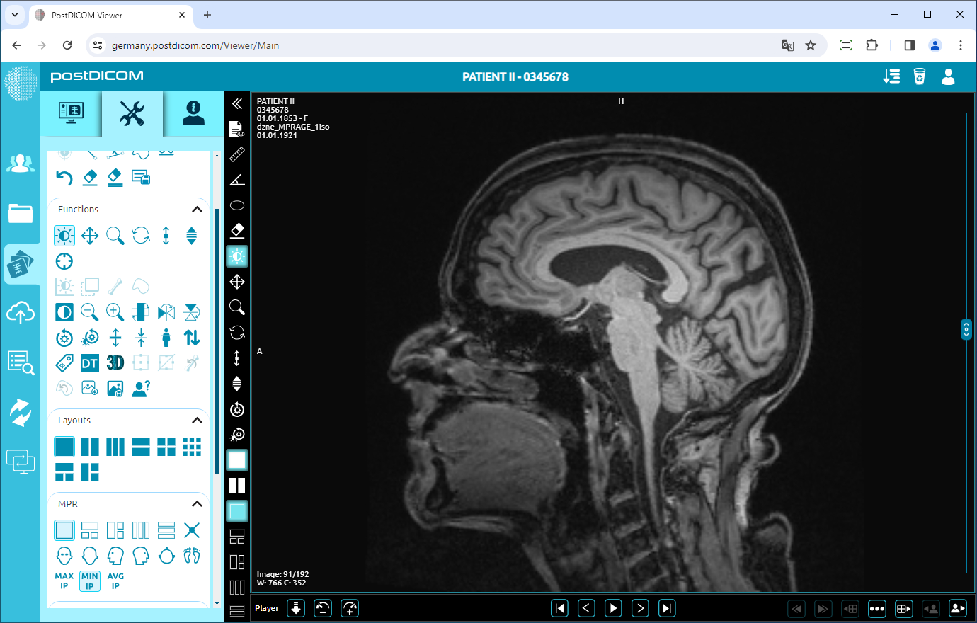 MPR-functies gebruiken